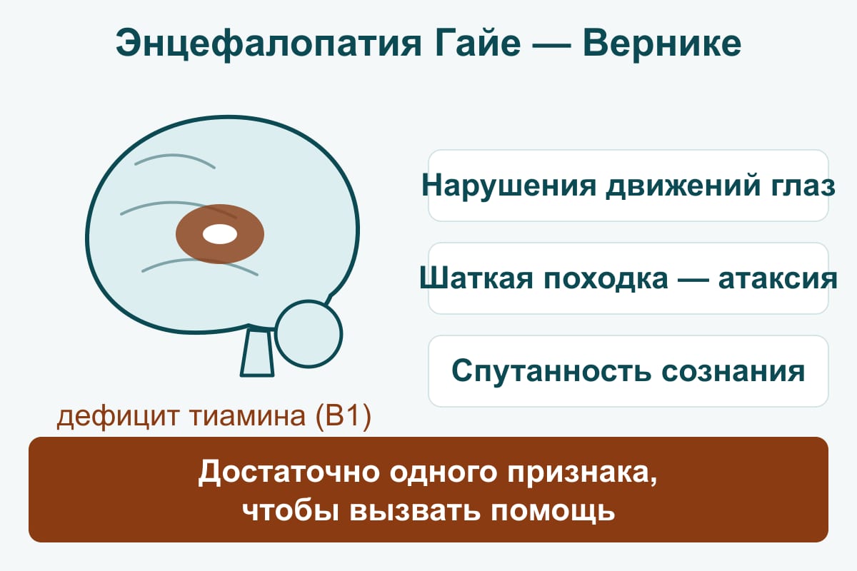 Схема триады Гайе — Вернике: нарушения движений глаз, шаткость, спутанность на фоне дефицита тиамина